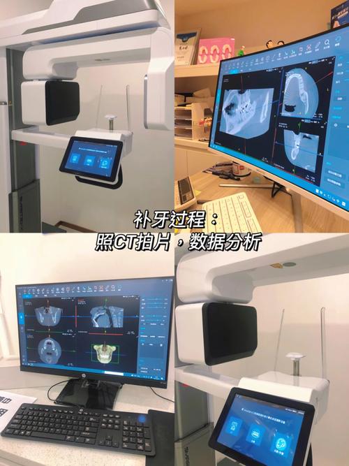 口腔健康與專業(yè)醫(yī)療服務 為何口腔護理和咨詢缺一不可